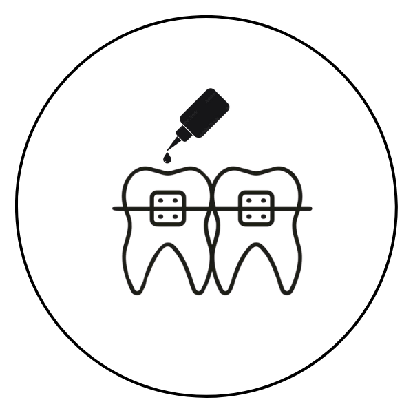 Etching gels, self-etch adhesives and light-cured flow adhesives for bonding orthodontic brackets.
