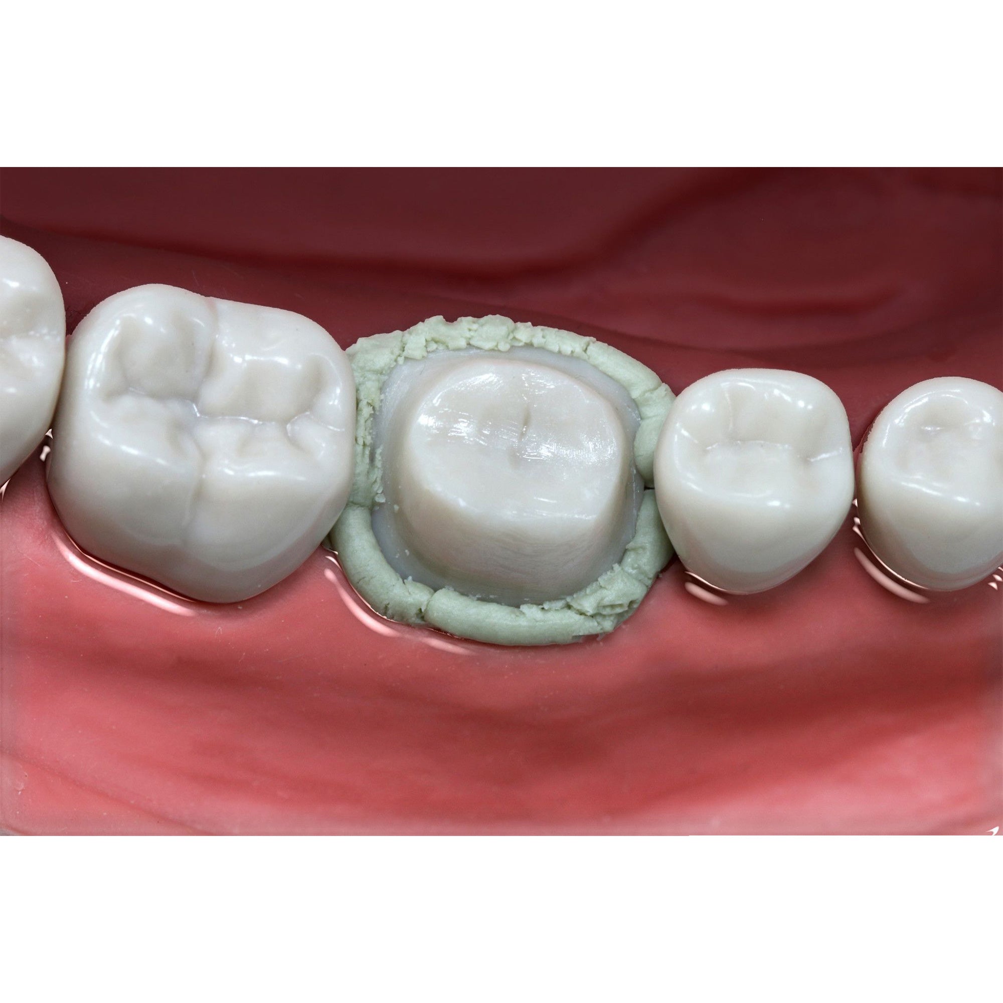 VMV Alumosil - Paste For Gum Retraction & Moisture Control 1.5g_4