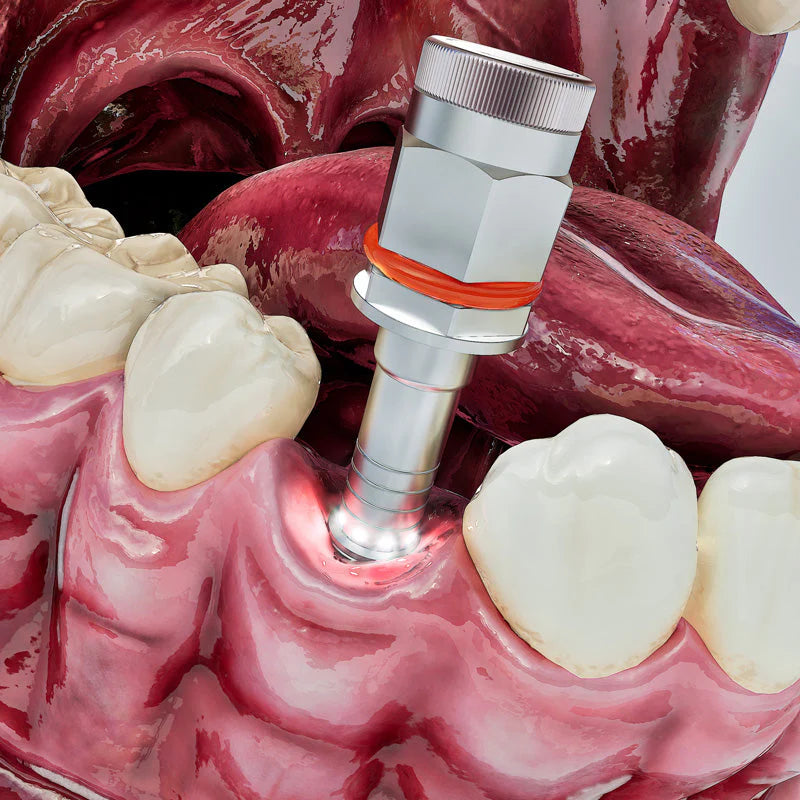 IMPLIGHT - Light-Guided Ratchet Driver For Implants - Internal Hex Connection Ø2.42mm