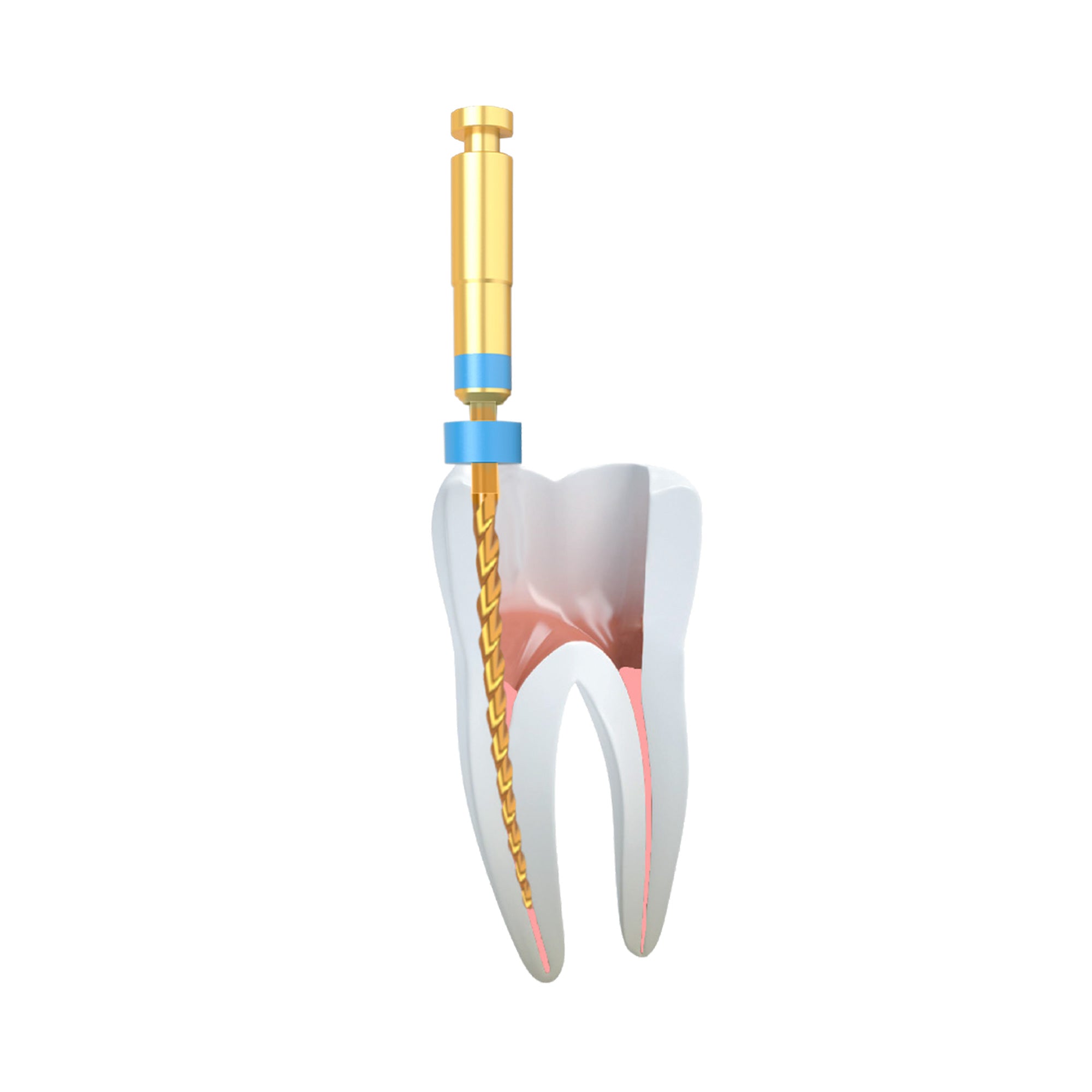 DIP ApexFile Gold Taper Endodontic Rotary Files For Root Canals 6pcs Pack_5