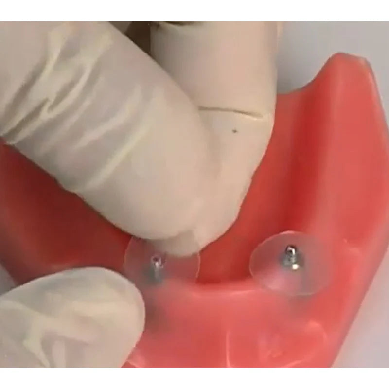 Prevents Acrylic or Cement Contamination – Ensures clean and precise workflow.