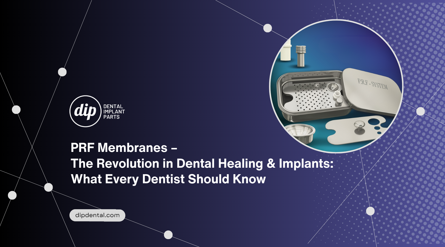 The Role of PRF Membranes in Contemporary Oral Surgery