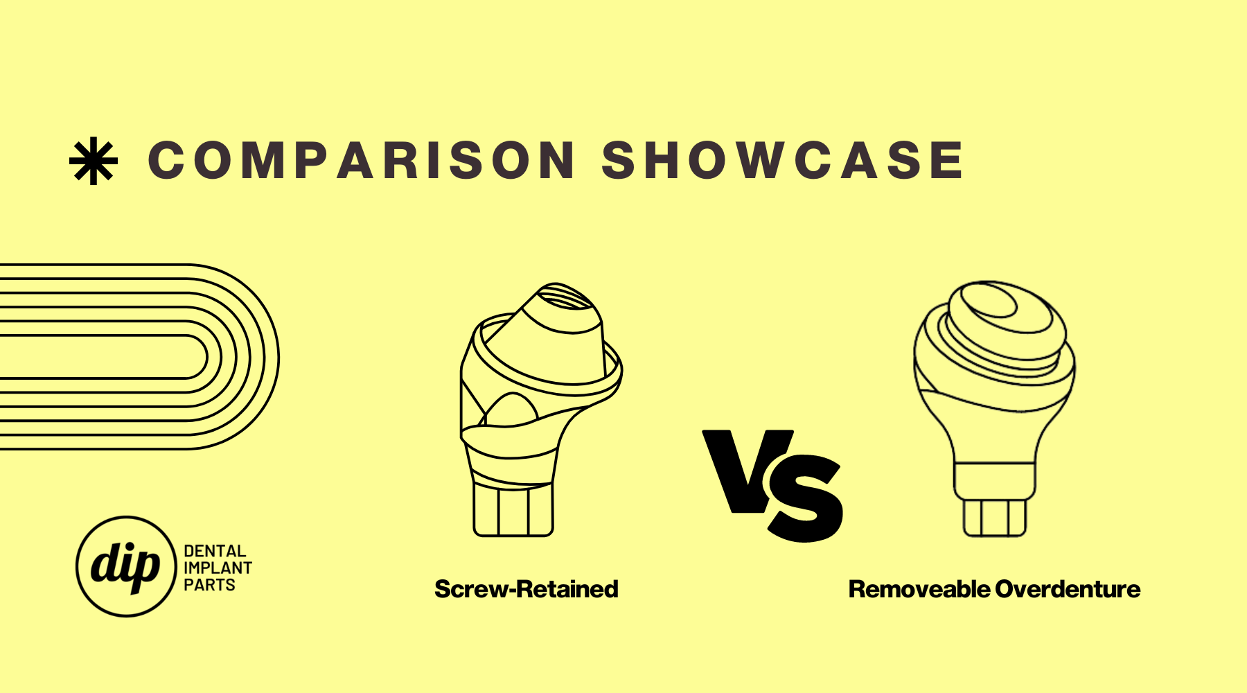 Screw-Retained vs. Removeable Overdenture