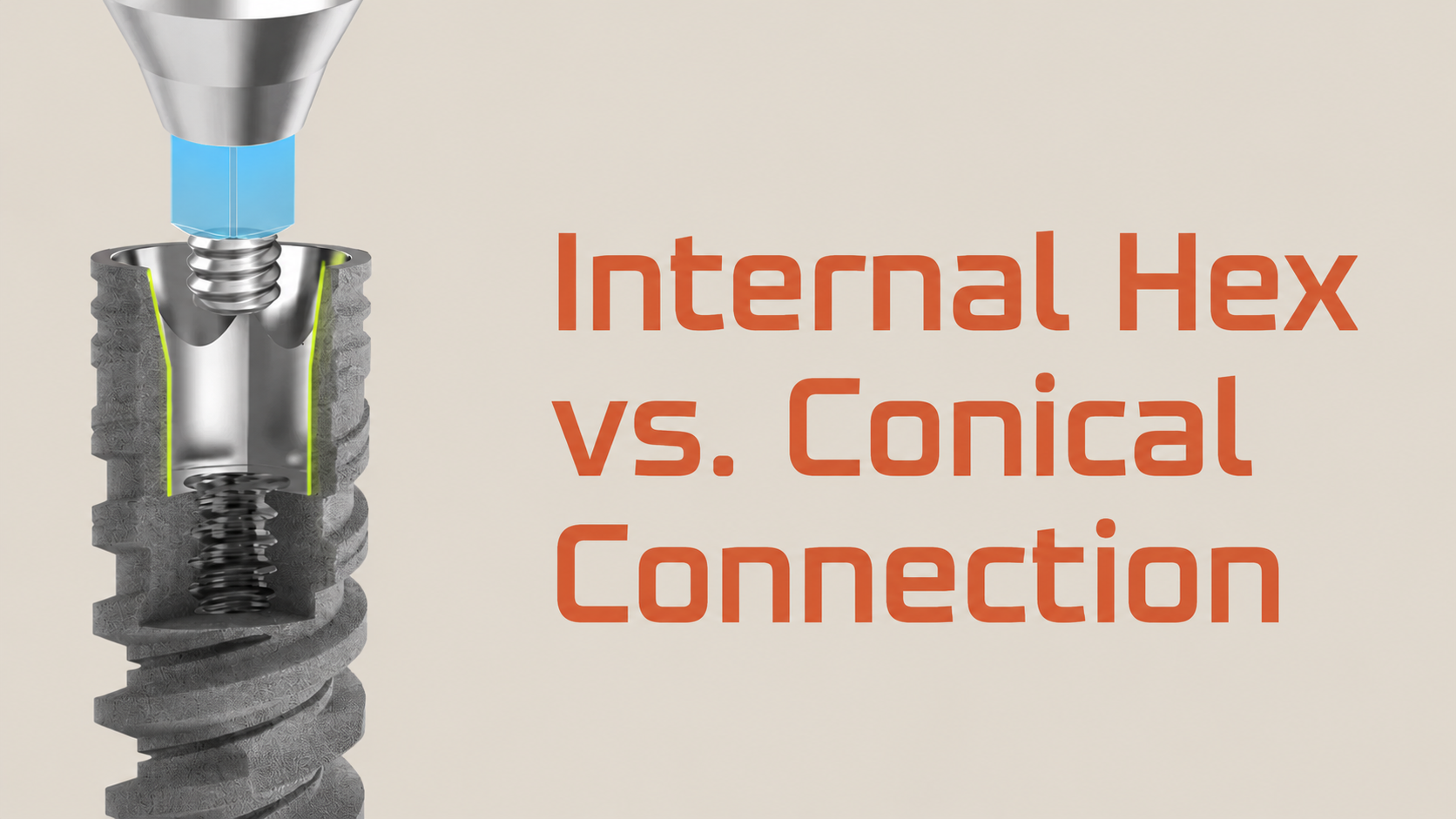 Conical Connection vs Internal Hex Implants