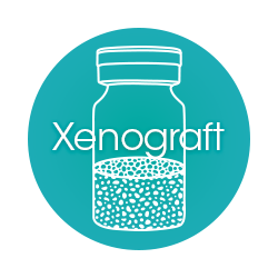 Xenograft Bone Graft