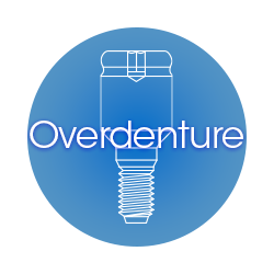 Overdenture Attachments