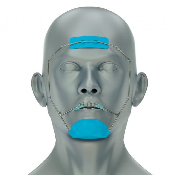 Reverse-pull protraction facemask headgear frame